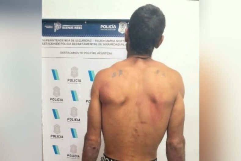 El sujeto detenido intentó agredir a los policías y al personal de la ambulancia, además de amenazar de muerte a su ex.