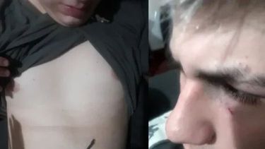 BRUTAL. El joven golpeado tiene 16 años.&nbsp;