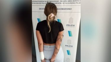 La agresora tiene 19 años y sufrió algunas quemaduras en el brazo.&nbsp;