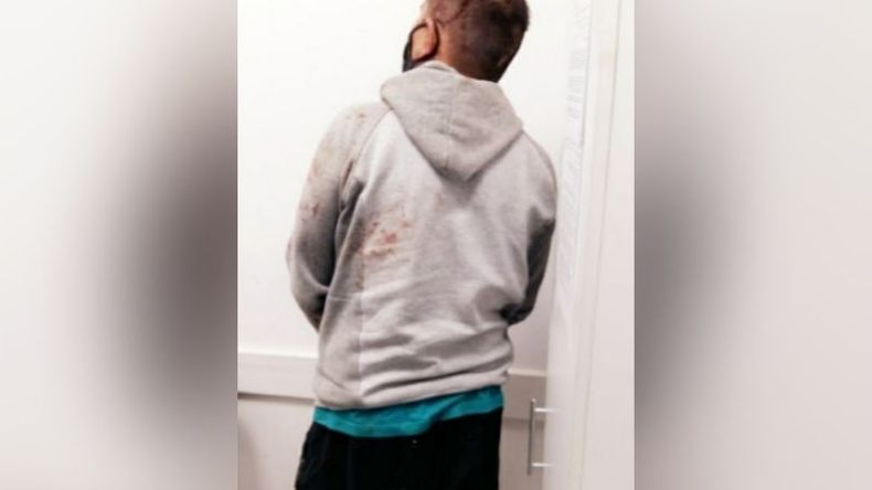 El sujeto tenía pedido de captura por robo calificado en grado de tentativa. .