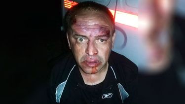 DESFIGURADO. Así quedó el hombre agredido el jueves..