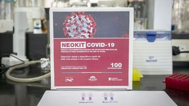 KIT. El nuevo testeo fue desarrollado por científicos del Milstein..