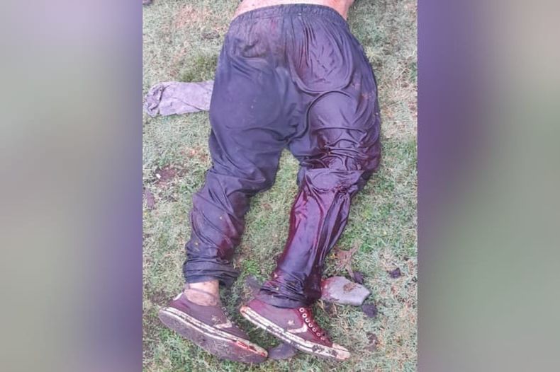 MAL HERIDO. El ladrón recibió un disparo en una pierna. Está fuera de peligro.